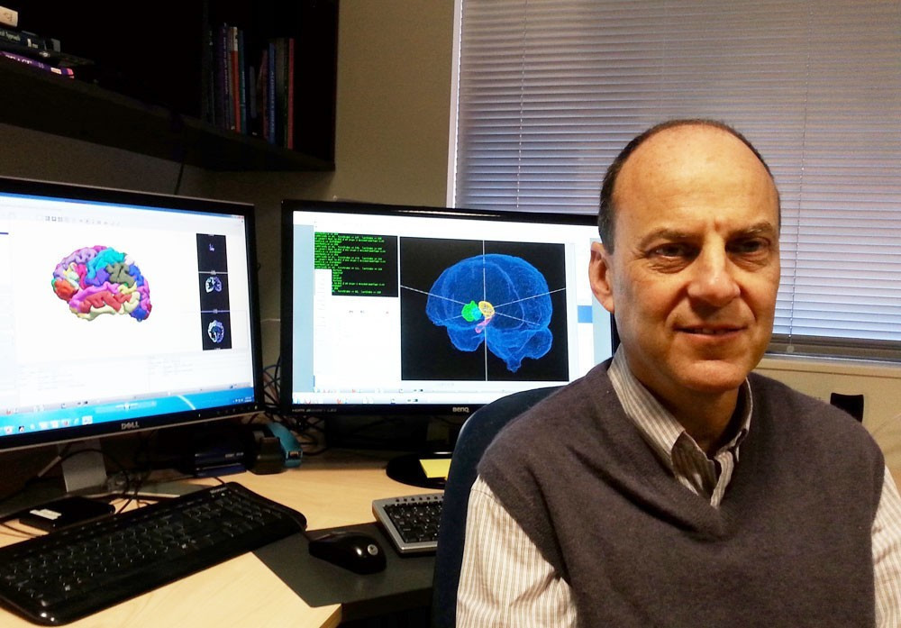 <p>Professor Starkstein’s study is the first to carry out sophisticated brain imaging analysis to identify brain structural and metabolic markers that predict the best motor response.</p>
