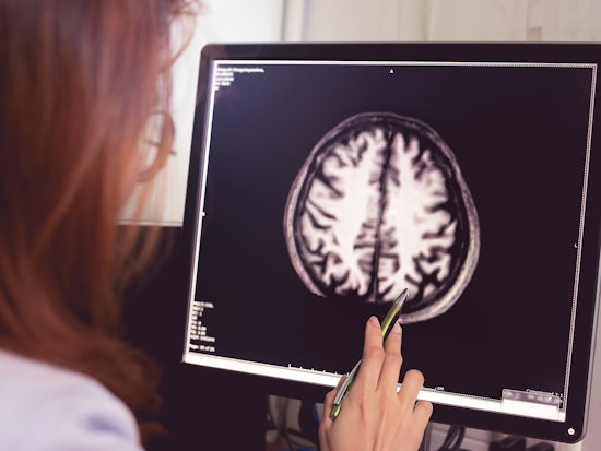 <p>The importance of dementia research has once again been highlighted (Source: Shutterstock)</p>
