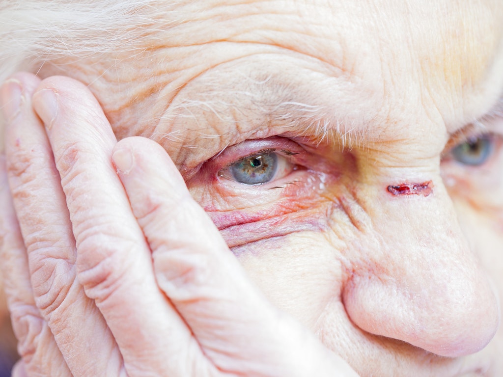 There were 2,862 serious assaults and sex attacks on nursing home residents over 2015/16 (Source: Shutterstock)