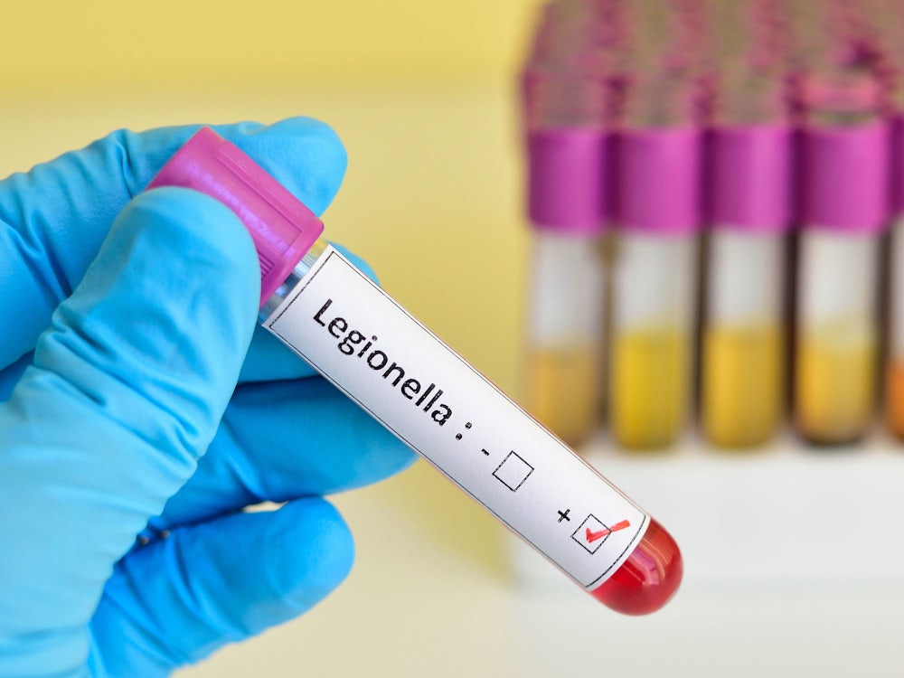 Calls to manage Legionella to protect an ageing population Aged Care Guide