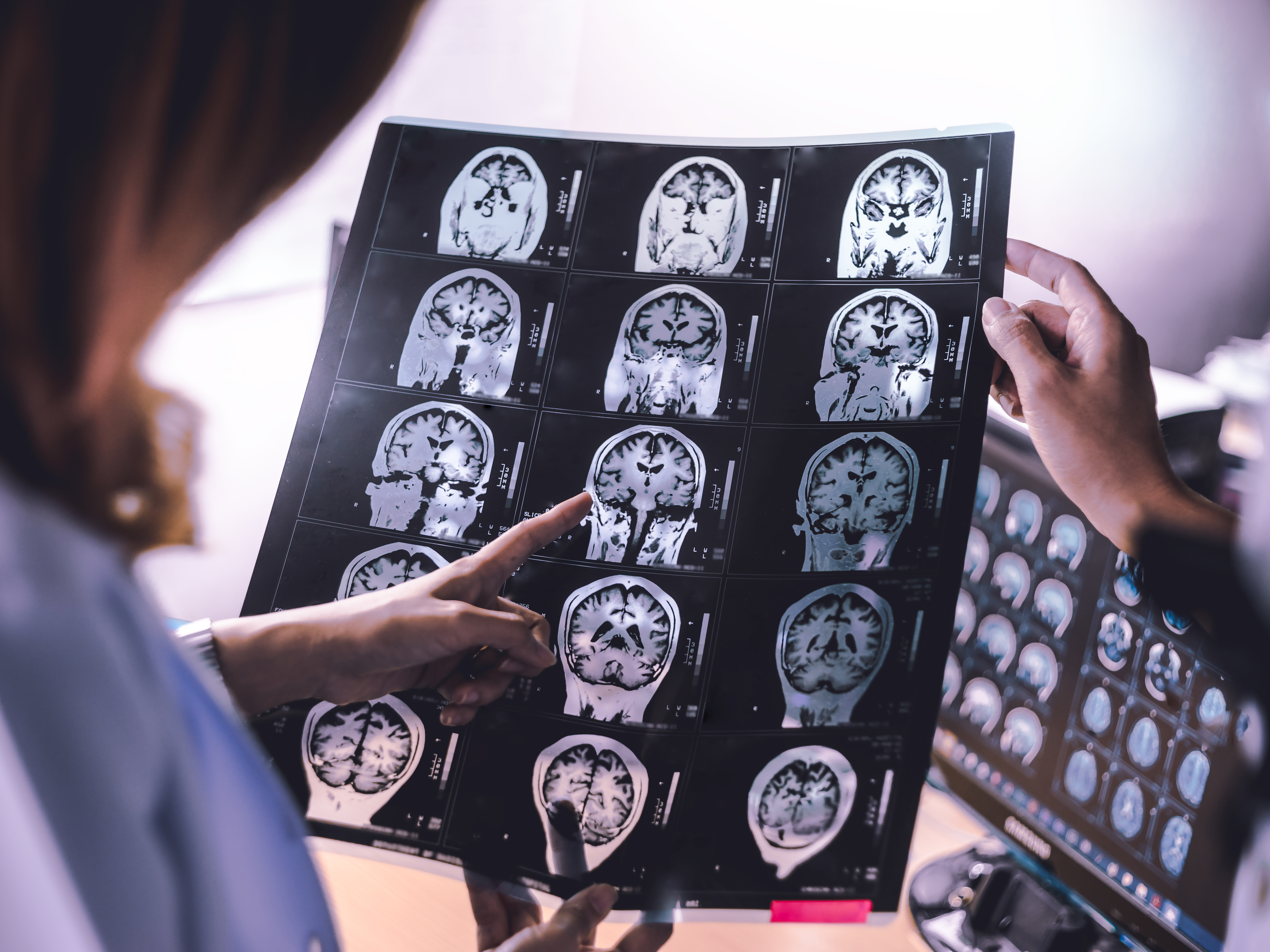 <p>There are an estimated 420,000 people living with dementia in Australia. (Source: Shutterstock)</p>
