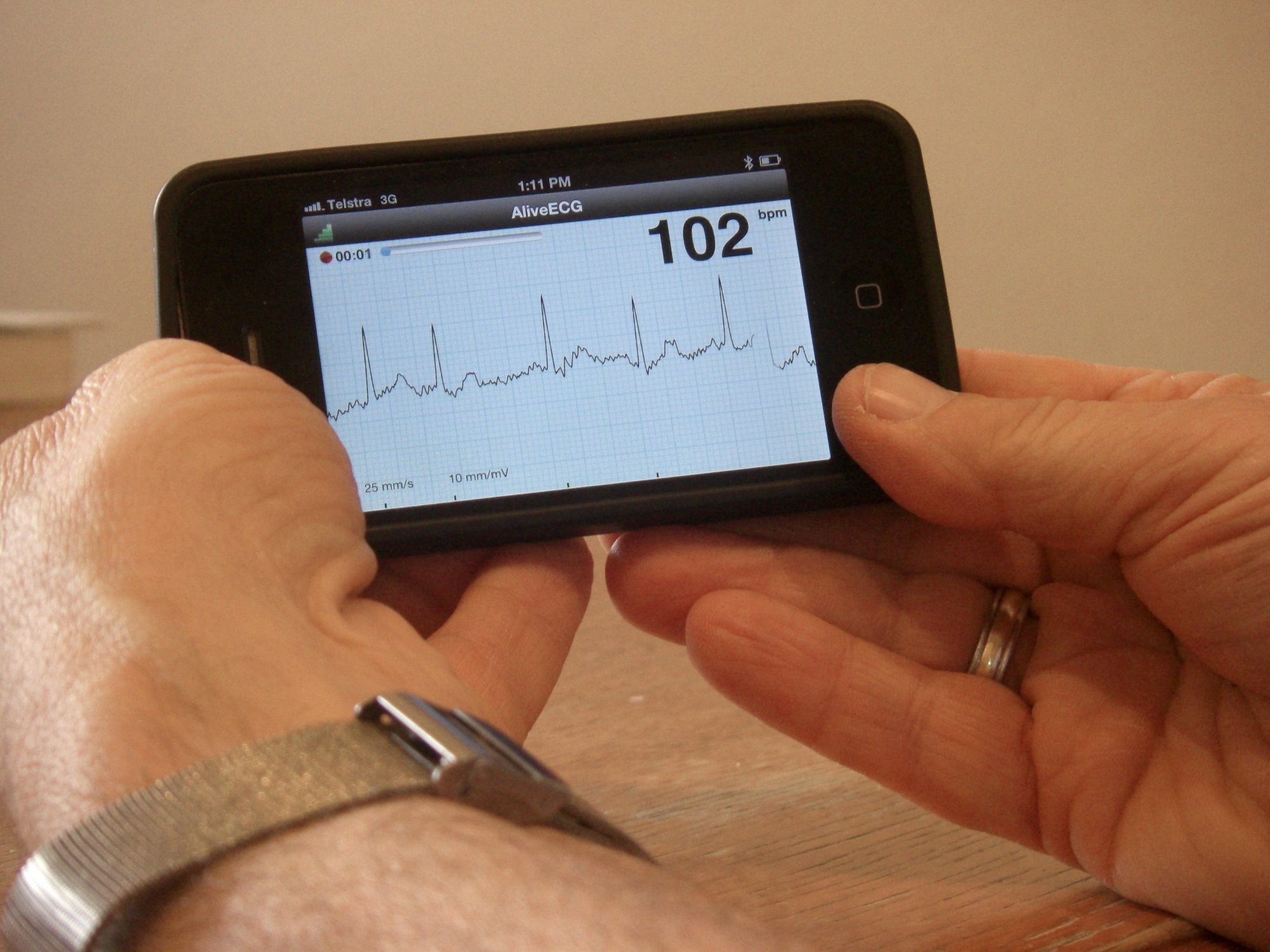 <p>The ECG test delivered over an iPhone.</p>
