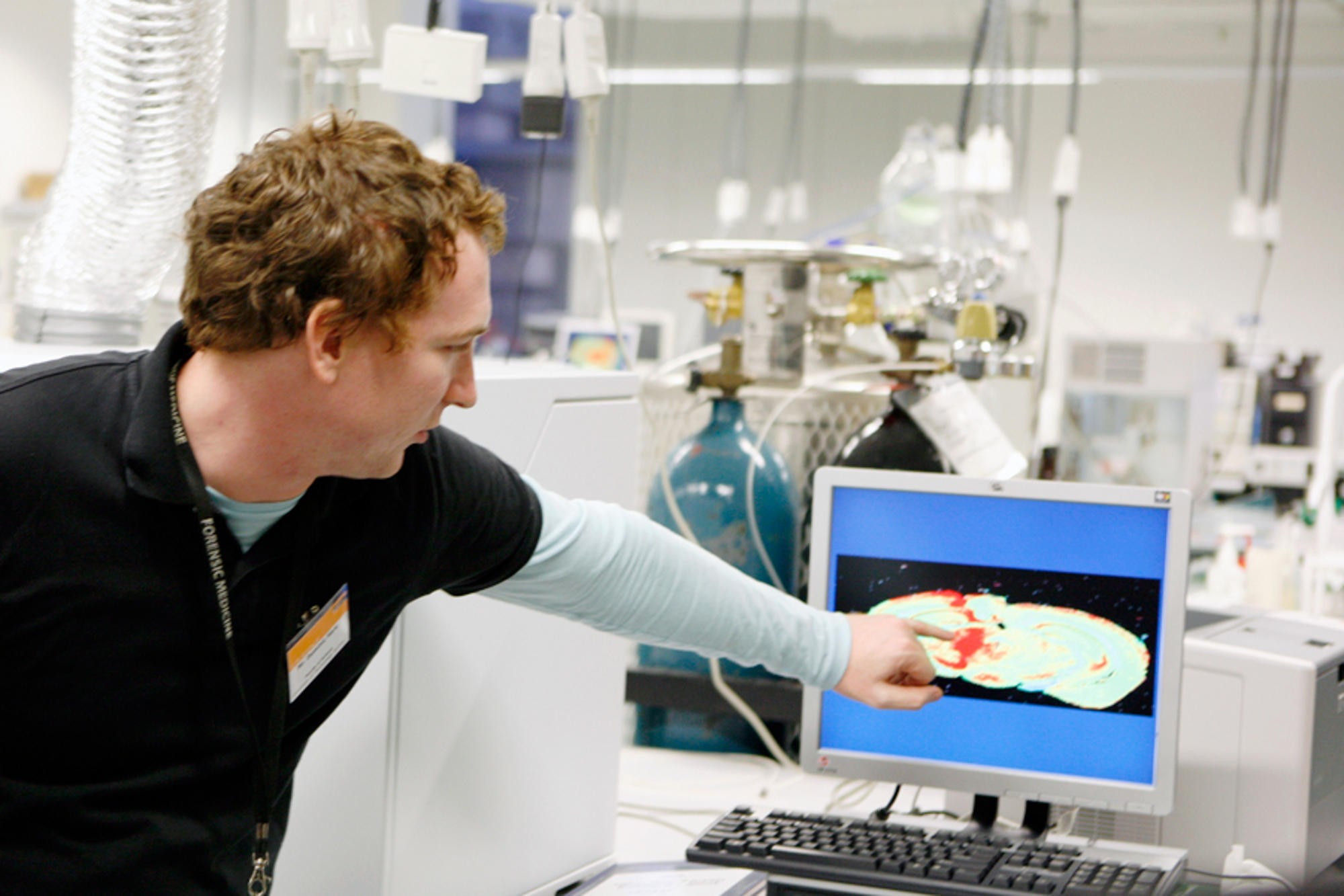<p>Dr Dominic Hare investigates the imbalance of iron and dopamine in the brain.</p>
