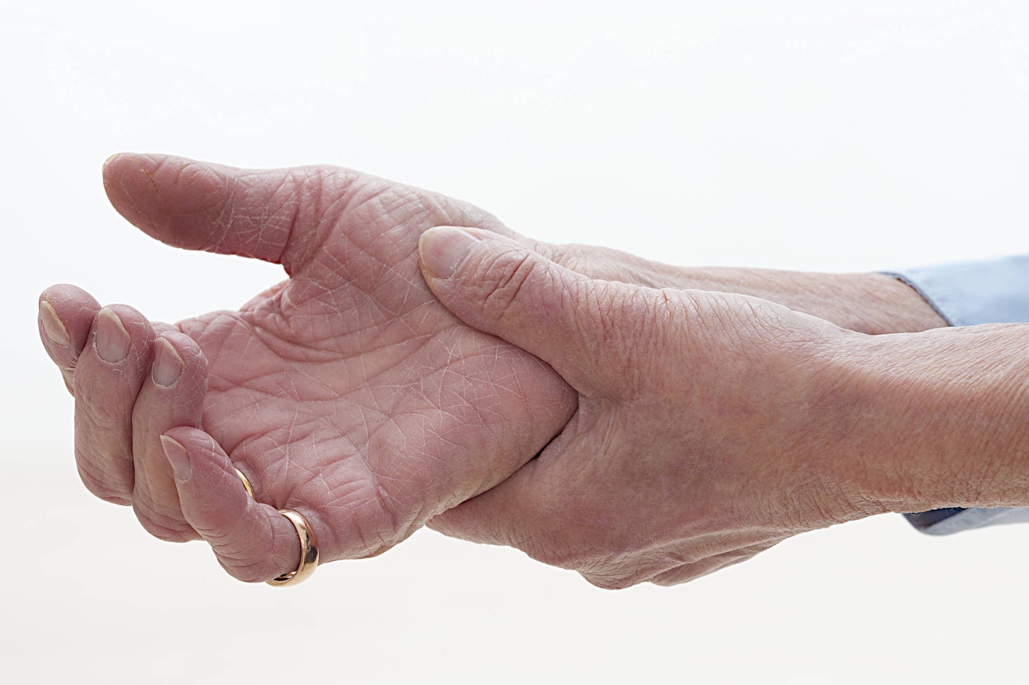 <p>Reducing the disabling impact of arthritis by assisting health workers to improve care and support for people with the condition is imperative.</p>
