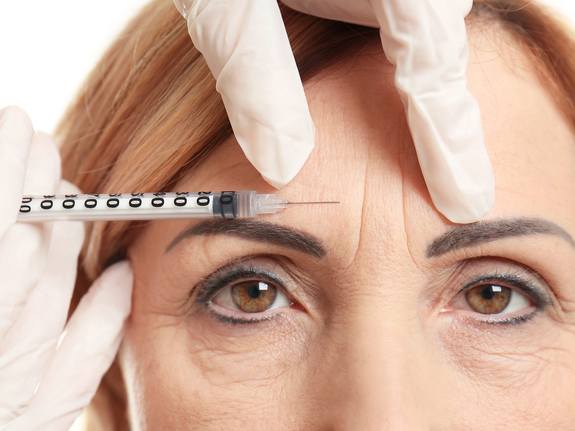 <p>The muscle-paralysing properties of Botox go way beyond aesthetical treatments (Source: Shutterstock)</p>
