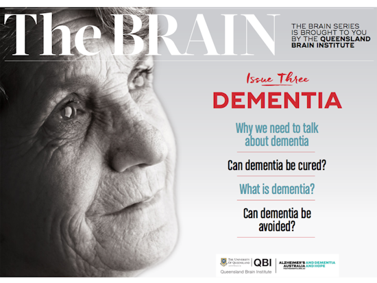 <p>The Brain: Dementia has been released on Wold Alzheimer’s Day 2017 (Source: Queensland Brain Institute)</p>
