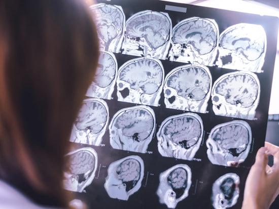 <p>Nineteen new projects have received a share of the $1.5 million to undertake dementia research. [Source: Shutterstock]</p>
