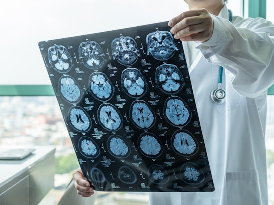 <p>The grant was awarded by the Dementia Australia Research Foundation (DARF) to support researchers aiming to improve dementia through research in Australia. [Source: iStock]</p>
