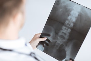 What is a spinal cord injury?