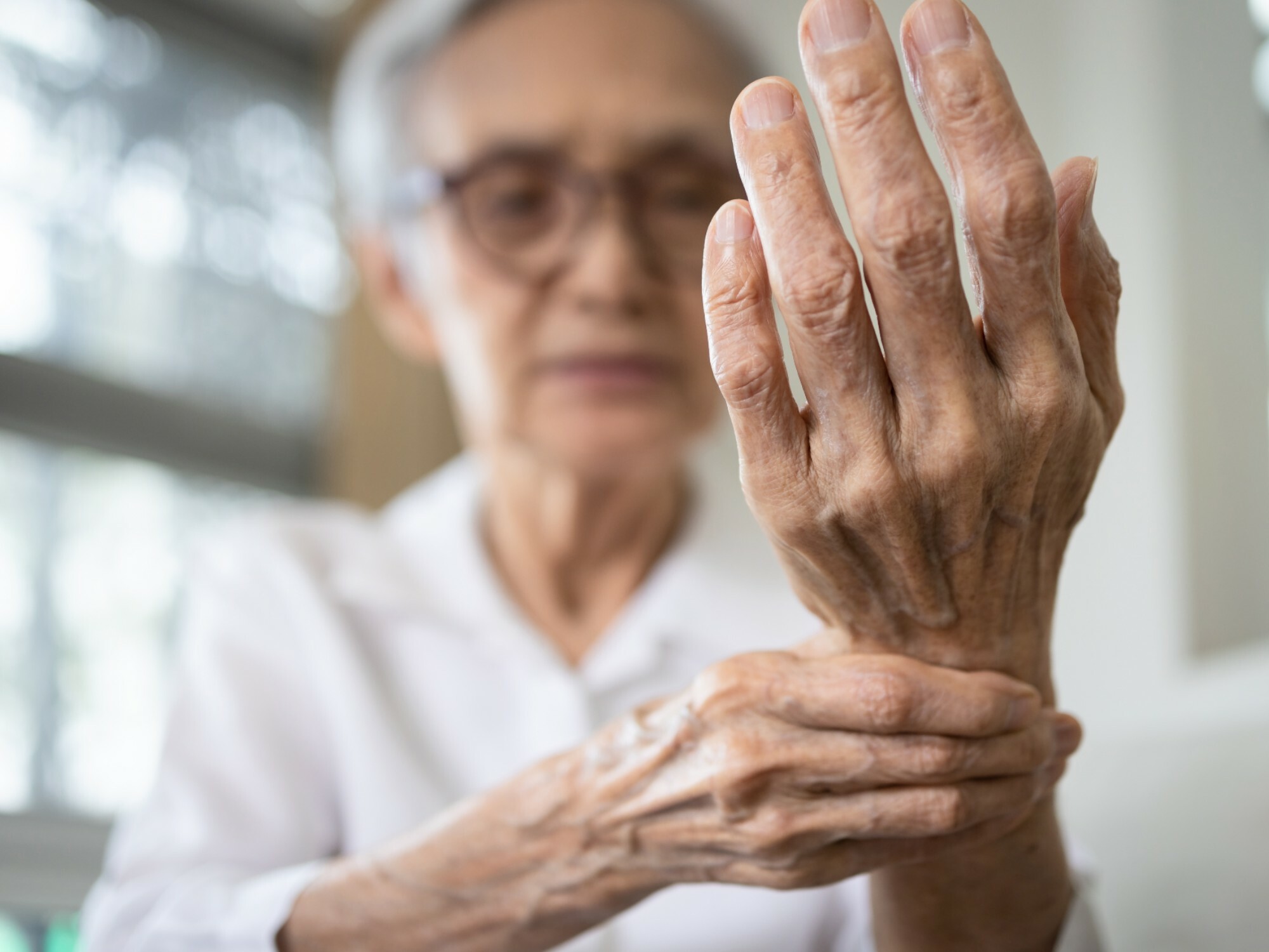 If you don’t move your body, it is possible that your arthritis may get worse or you might start losing basic skills. [Source: Shutterstock]
