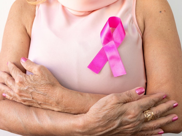 Breast cancer is one of the most common types of cancer, affecting many older women with 60 the average age of diagnosis. [Source: iStock]
