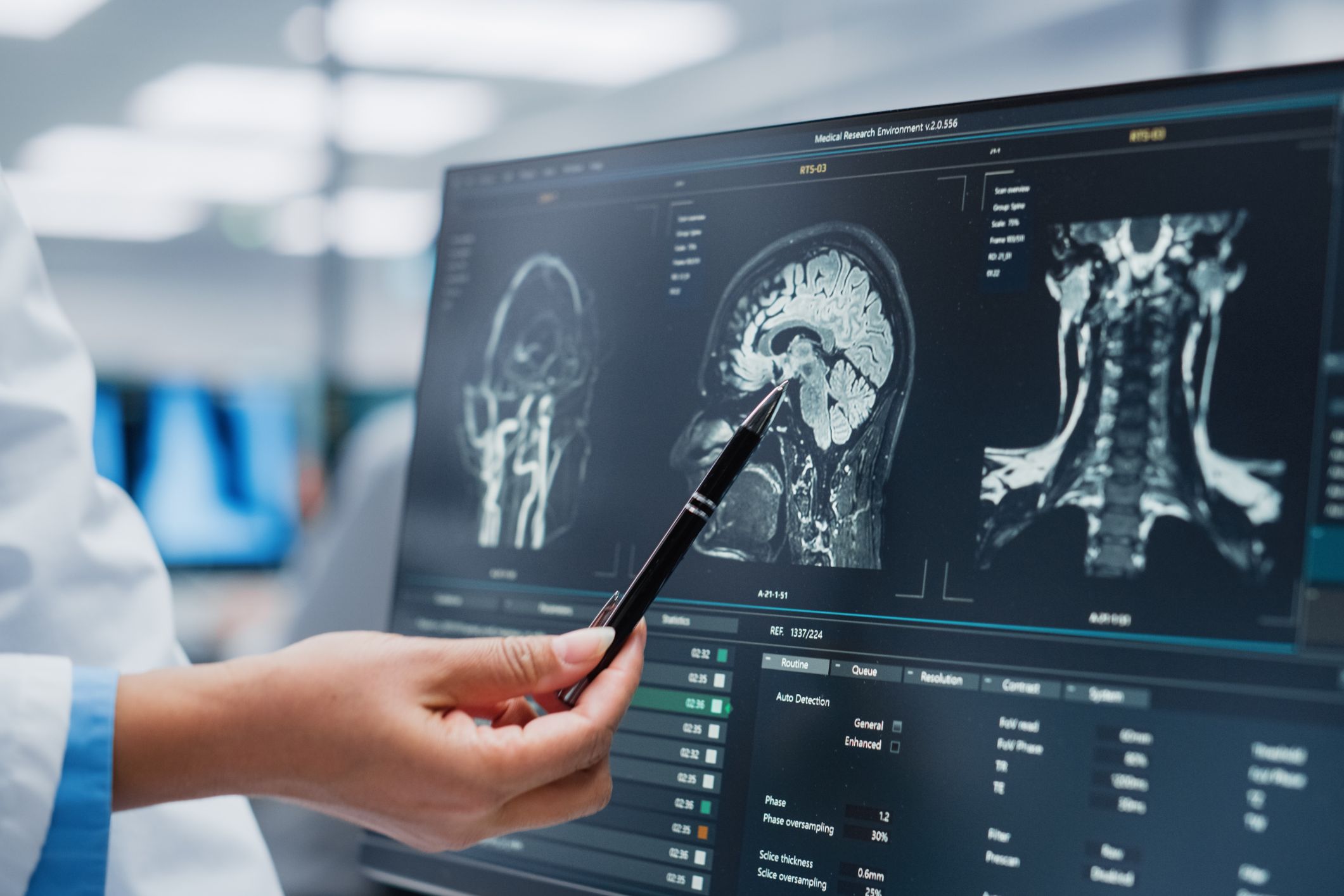 Link to New hope for Australians with Huntington’s disease article