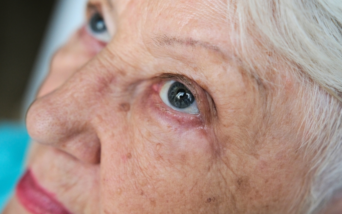 Link to Vision loss reforms could leave older Australians ‘out to dry’ article